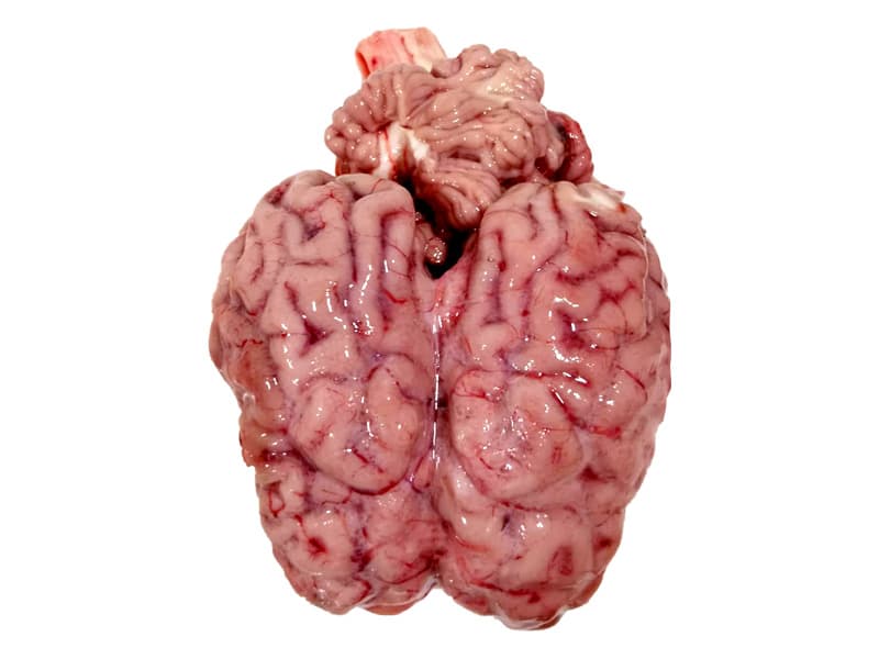 Brain